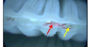 A microscope image of microfibers trapped in an oyster gill.